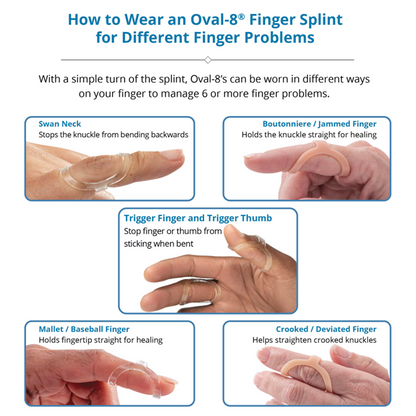 How to wear the clinically trusted  Oval-8 Finger Splints . Proven to help multiple finger and thumb conditions to reduce pain and enhance mobility to  manage  Mallet Finger, limit Swan Neck or Hypermobility, prevent Trigger Finger/Thumb popping & stabilize Crooked, Jammed or Arthritic Fingers   
