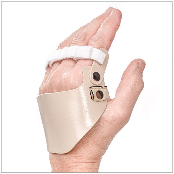 Radial hinged ulnar deviation splint -Designed by a hand specialist, it reduces moderate to severe deviation from Rheumatoid Arthritis to improve hand function    